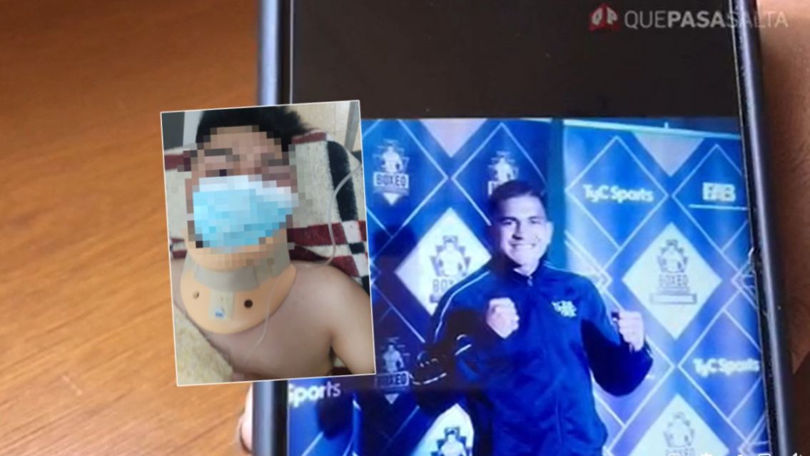 Boxeador salteño casi mata a golpes a un muchacho: lo desfiguró por completo