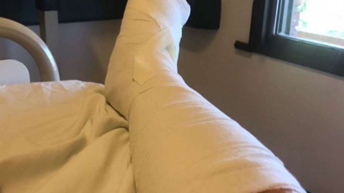 Famosa influencer quiso hacer un desaf�o y casi le amputan la pierna, "sent� que me mor�a"