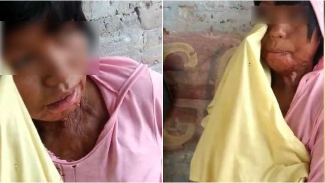 Piden ayuda para los wichís que "se naftean". Se drogan con combustible y mueren quemados