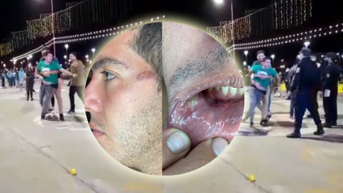 Sobrino del vicegobernador de Jujuy denunció a la Policía por abuso de autoridad