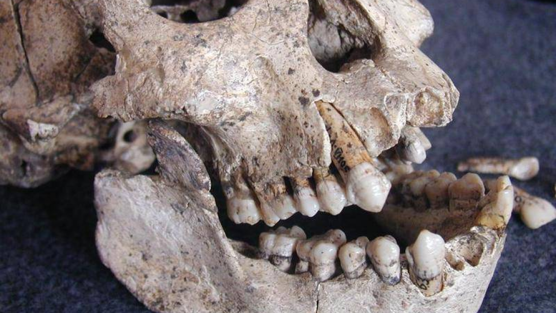Asquerosas im�genes de un consultorio dental trucho. Temrin� clausurado