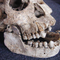 Asquerosas imágenes de un consultorio dental trucho. Temrinó clausurado