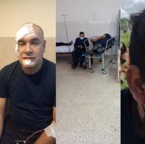 Por evitar cortes de ruta: 13 policías jujeños terminaron heridos y hospitalizados