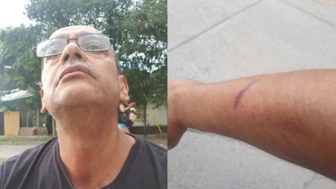 Periodista fue a ver a La Renga y terminó con moretones: "Violencia policial"