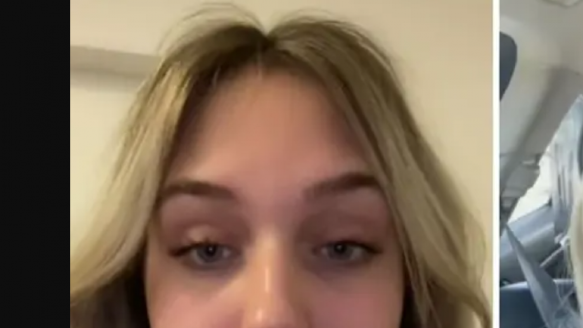 Se hizo un tratamiento para rellenar los labios y quedó igual a Homero Simpson