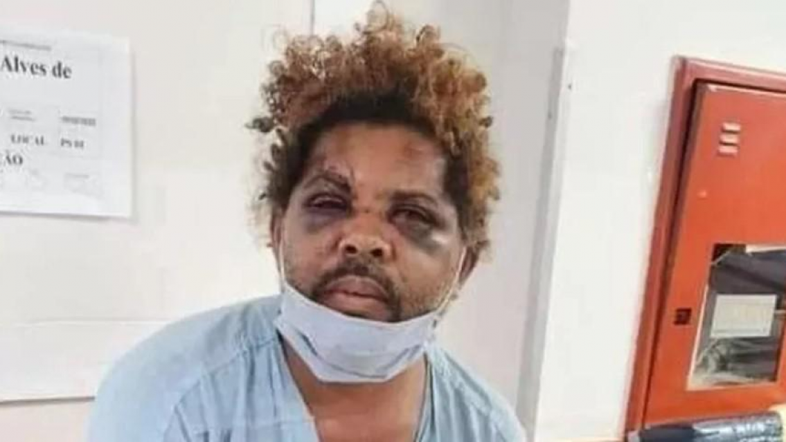 Encontr� a su mujer teniendo sexo con un hombre que vive en la calle, as� lo dej�