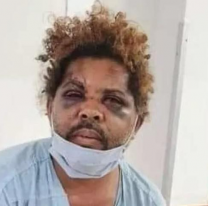 Encontró a su mujer teniendo sexo con un hombre que vive en la calle, así lo dejó