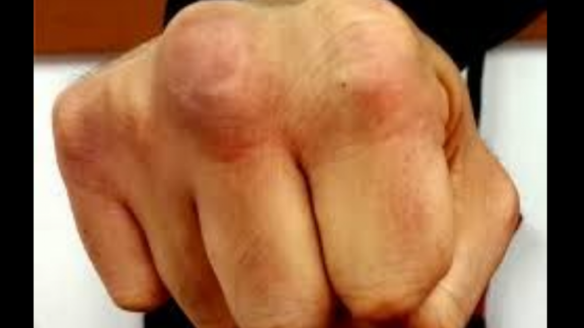 Se agarró a las piñas con su hermano, su papá se metió y murió. Se arrepiente de por vida