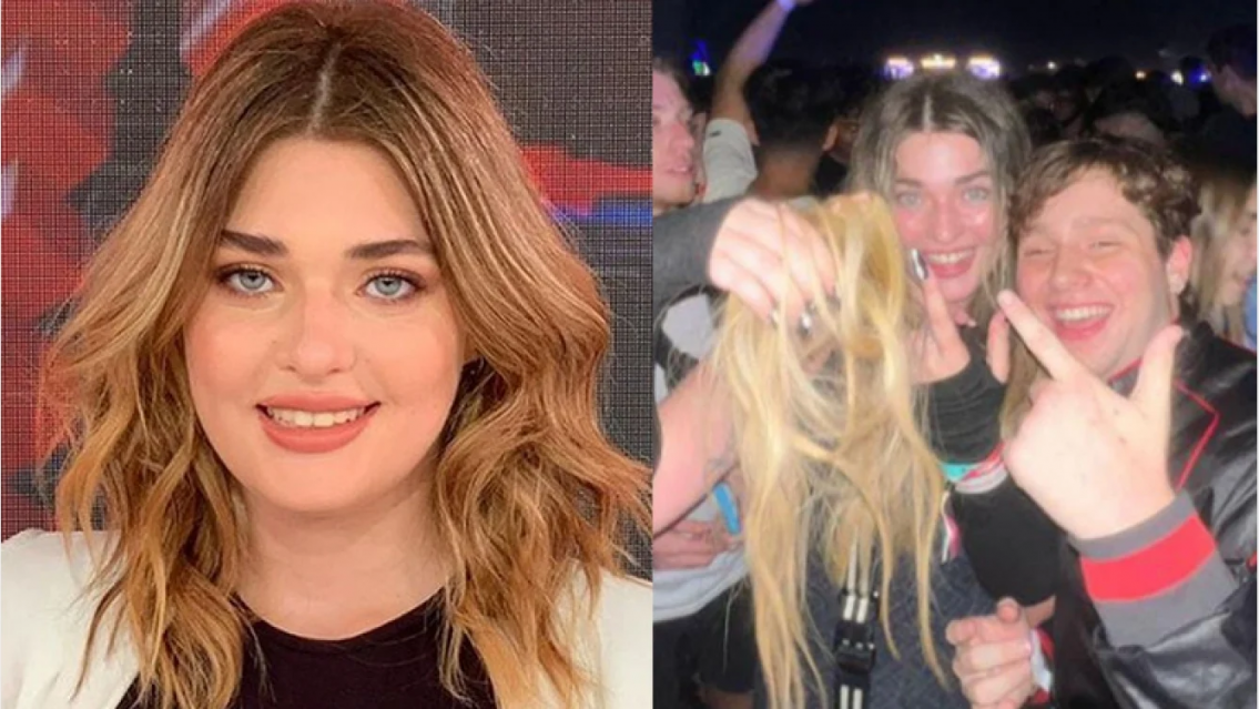 ¡Un horror! En pleno Lolla, a Martita Fort se le salió la peluca que usa y nadie sabía