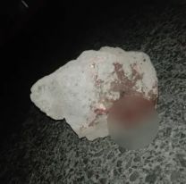 Jujeño le partió la cabeza a su hermano con una piedra: lo mandó al hospital