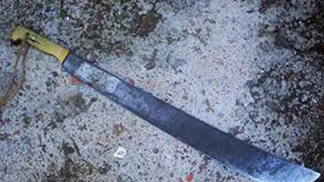 Dos juje�as se pelearon en la calle: el novio de una le cort� un dedo con un machete