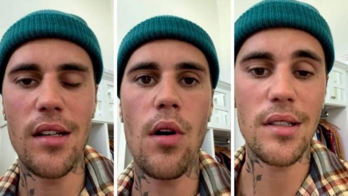 Justin Bieber sufri� un derrame y tuvo que suspender su gira. Pide que oren por �l tras su par�lisis 