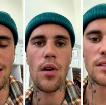 Justin Bieber sufrió un derrame y tuvo que suspender su gira. Pide que oren por él tras su parálisis 