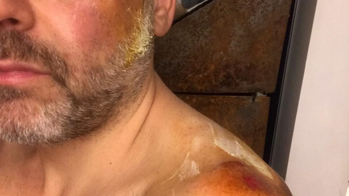 El dolor de Muscari por esta terrible p�rdida. Se muri� su amiga, era muy joven