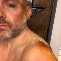 El dolor de Muscari por esta terrible pérdida. Se murió su amiga, era muy joven