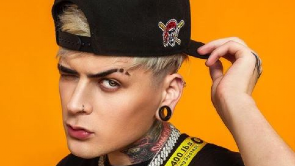 As� le qued� la cara a Lit Killah: en pleno escenario, la llama le lleg� hasta el rostro