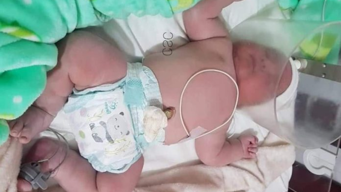 Cerca de Jujuy nació un "Súper Bebé", cuánto pesó y cómo está su mamá