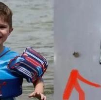 Un chico fue mordido por una garrapata y casi muere, pero su madre lo salvó