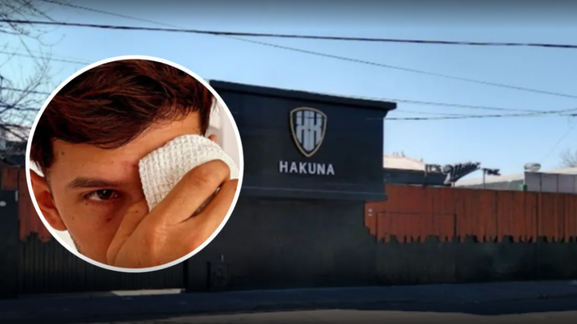 Molieron a palos a un inflluencer juje�o a la salida de un boliche: Es muy conocido