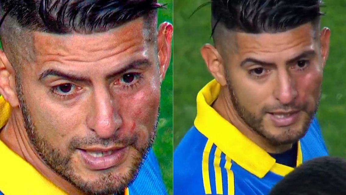 Zambrano rompi� el silencio tras su pelea con Benedetto: "Fue un guantazo"