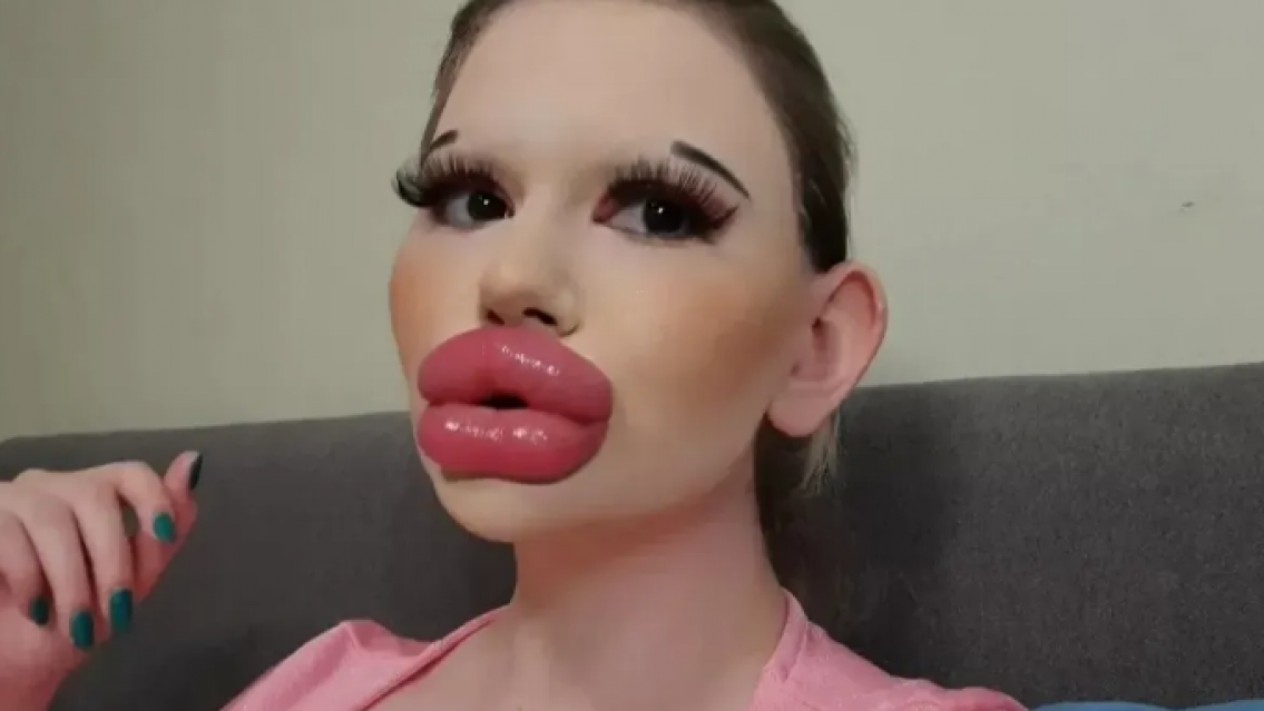 No la reconoce ni su familia, as� es la vida de "la Barbie humana". Me invitan hombres de...