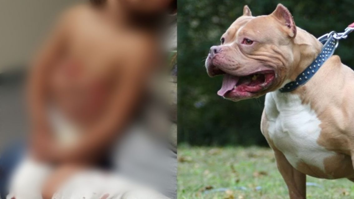 Brutal ataque de un pitbull a una nenita de 4 a�os: "La beb� estaba jugando"