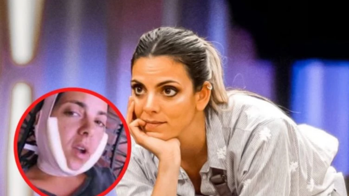 El precio de la belleza, Belu Lucius pas� por el quir�fano y as� qued�. �C�mo duele!