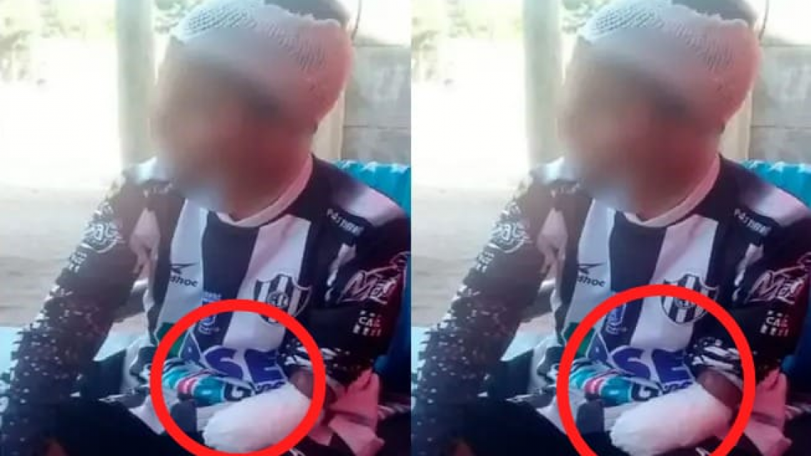 Perd�n se�or... Abuelo estall� de furia por c�mo dejaron a su nieto ladr�n. Le arrancaron un brazo