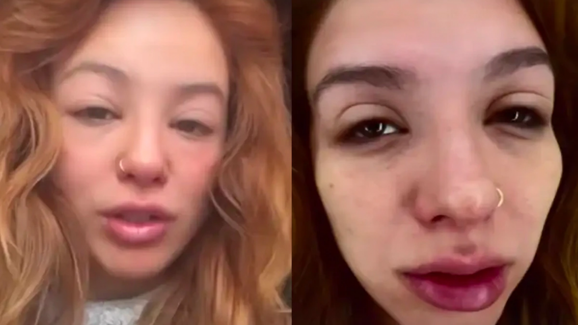 Aunque no lo crean, ¡es Flor Vigna! Le quedó la cara desfigurada