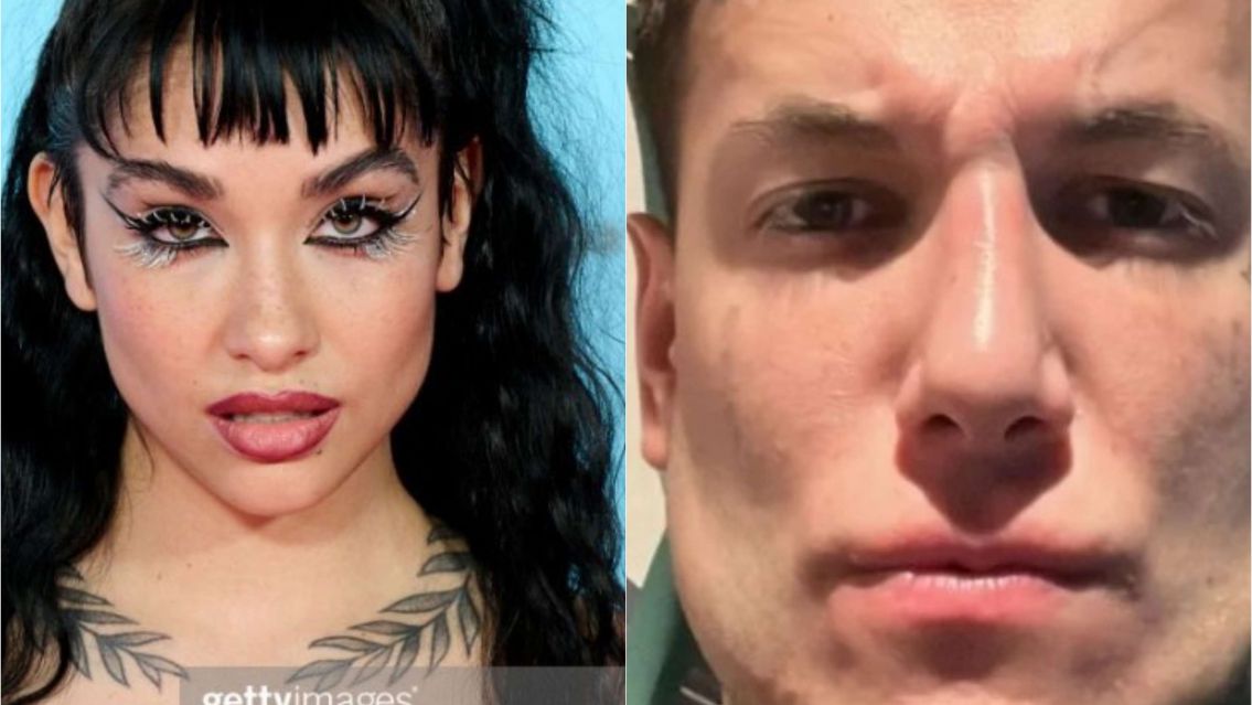 María Becerra apareció con la misma cara que Alex Caniggia ¿Se operó?