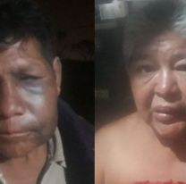 Horroroso caso en Jujuy: Terrible golpiza a una pareja de abuelos