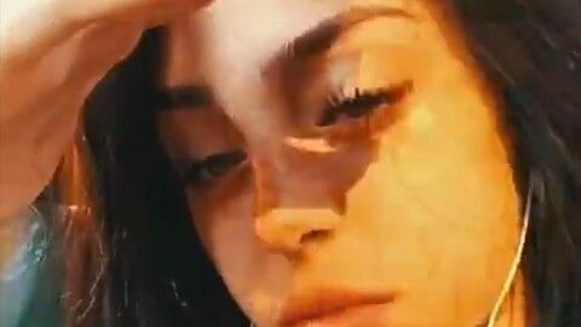 Preocupa la salud de Nicki Nicole, apareci� con una tremenda cicatriz en la cara