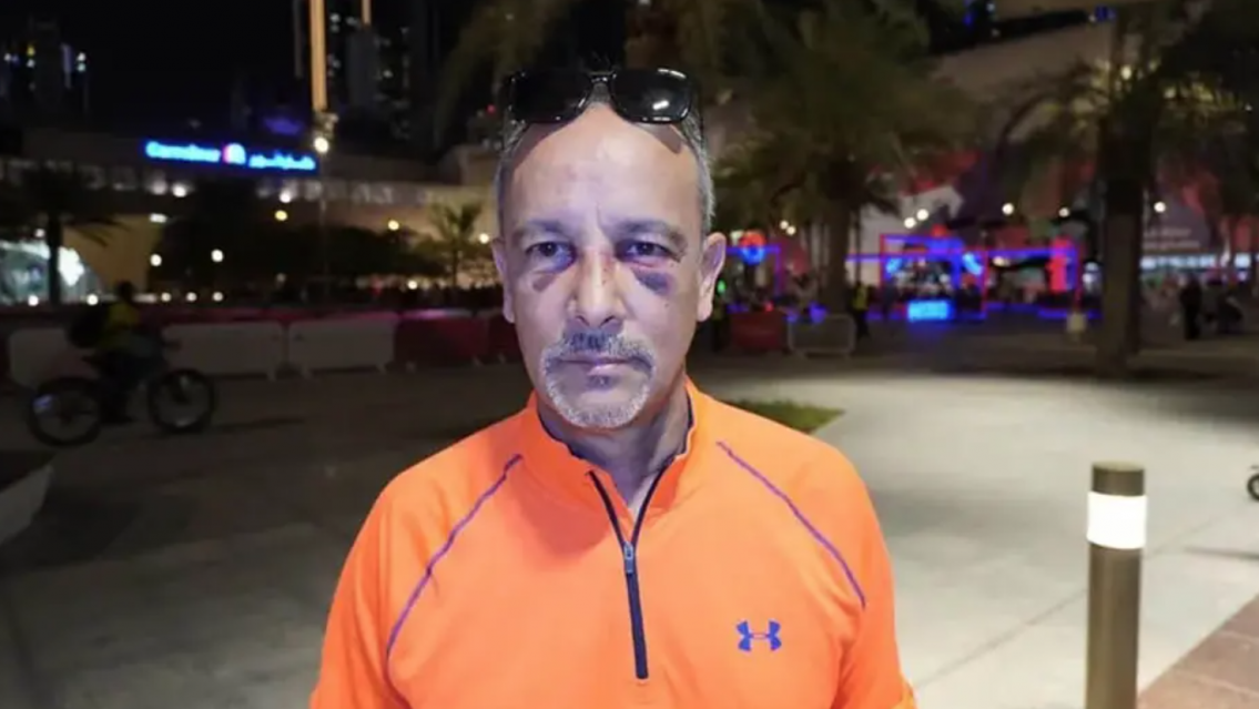 En pleno estadio, argentino sufri� una brutal paliza por cuatro mexicanos