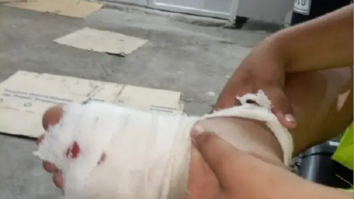 Norteñito fue a la pileta y volvió así, las peores vacaciones de su corta vida