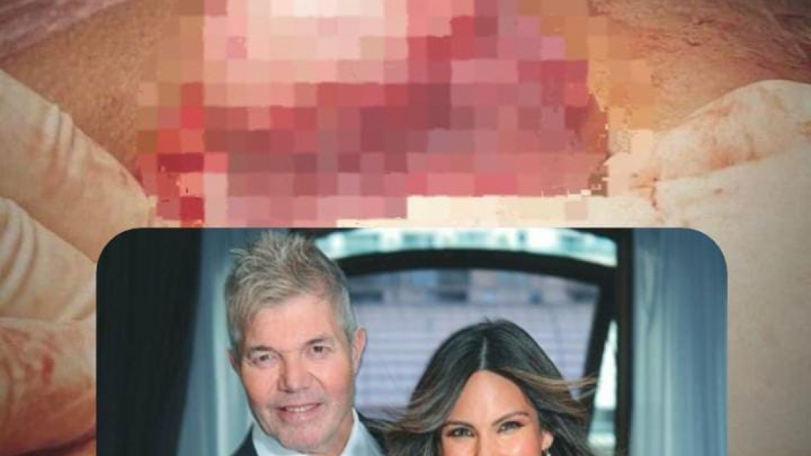 �Es un tumor? Barby Franco mostr� lo que le sacaron en el parto de su hijo