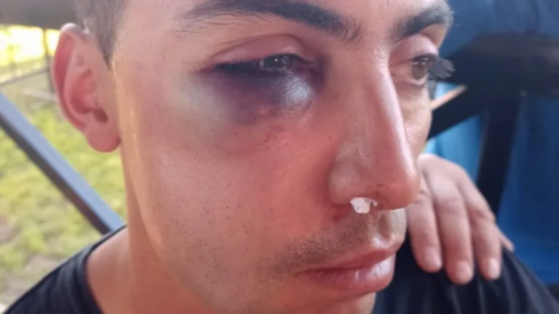 Esc�ndalo con Sele Vera, uno de sus colaboradores le dio una paliza a un chico