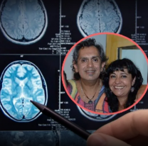 Qué es el Aneurisma Cerebral, el ataque que sufrió la mujer de Mario Teruel