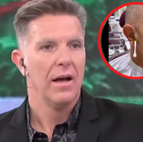 Extra doloroso: así se depila Alejandro Fantino sus "agujeros"