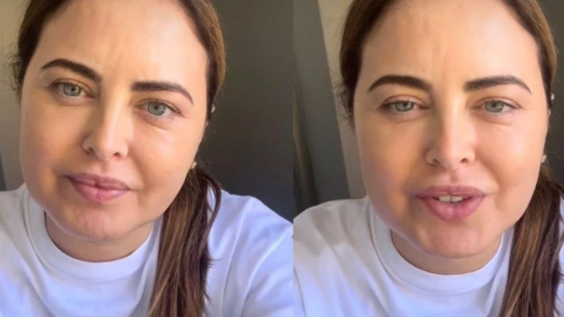 As� se ve Silvina Luna hoy, espera un trasplante y lucha por su vida