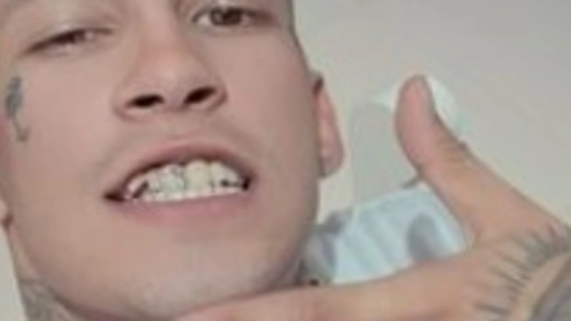 El tratamiento estético al que se sometió L-Gante. Todos se burlaban de él por esto