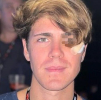 ¡Un moretón así de grande! Mostraron cómo tiene el ojo Marcos Ginocchio