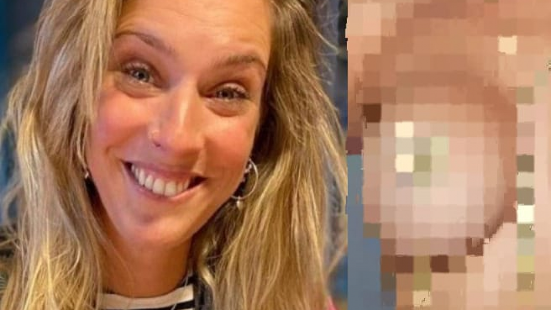 Dani la Chepi contó todo, se le infectó feo el pezón. "Nos vemos pronto"