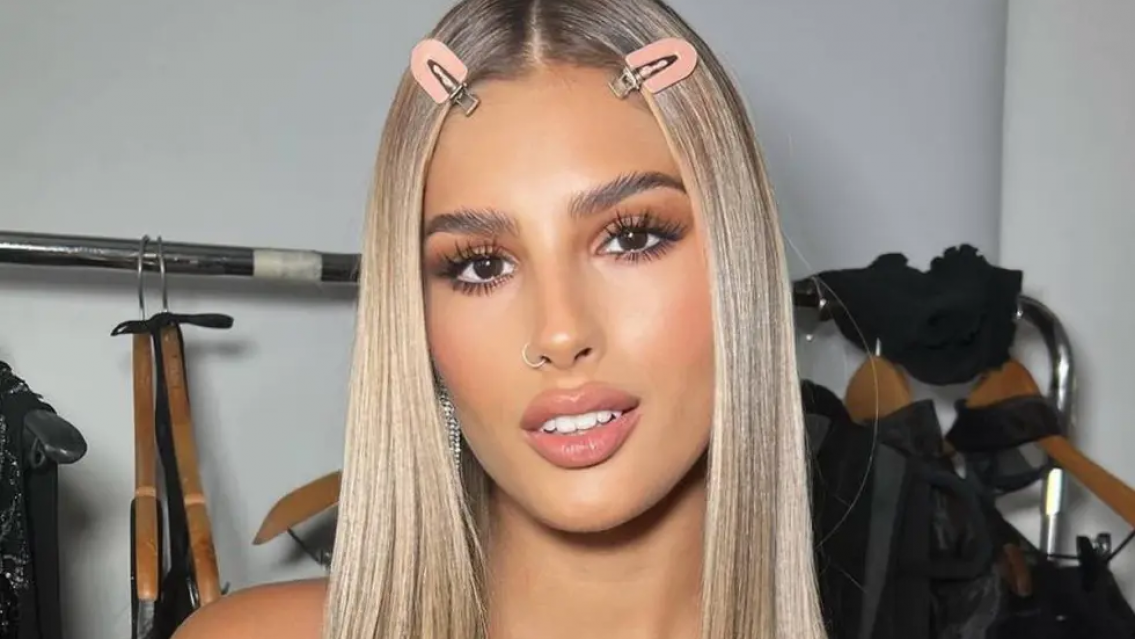 As� qued� Julieta Poggio luego del retoque est�tico que se hizo al salir de Gran Hermano