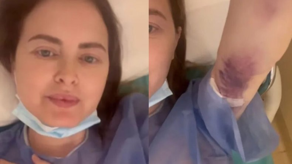Alarmante situaci�n de Silvina Luna en el quir�fano. �Un hematoma as� de grande!