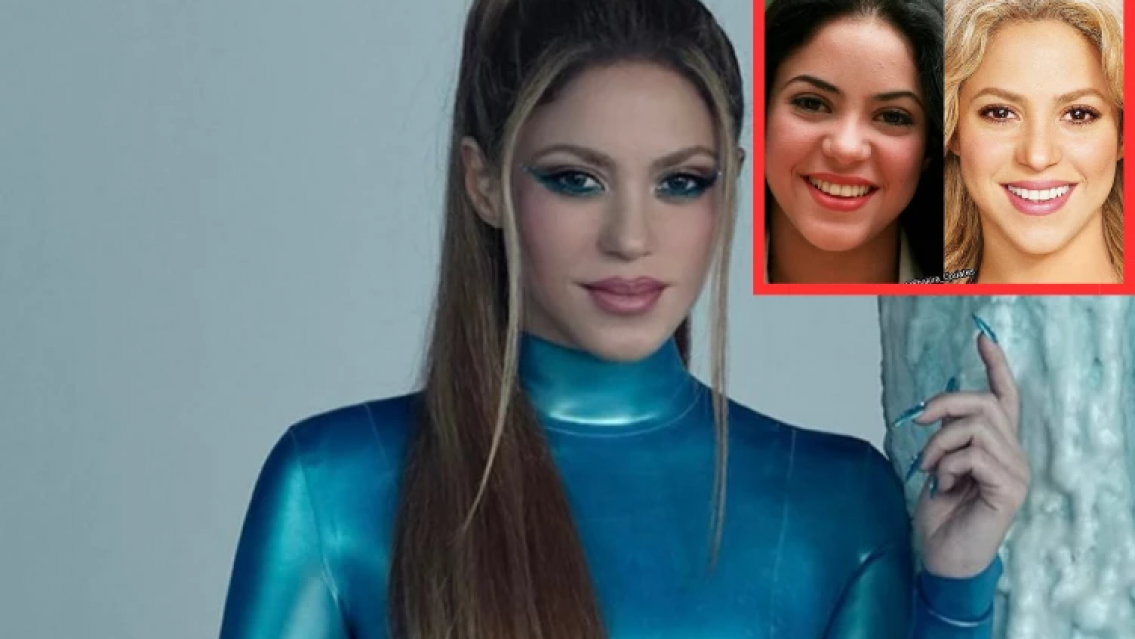 ¡Era directamente otra persona! Una a una las cirugías que se hizo Shakira