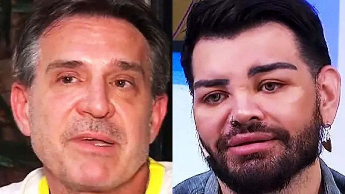 Otra m�s del "doctor" Lotocki, le arruin� el rostro a un ex Cuesti�n de Peso