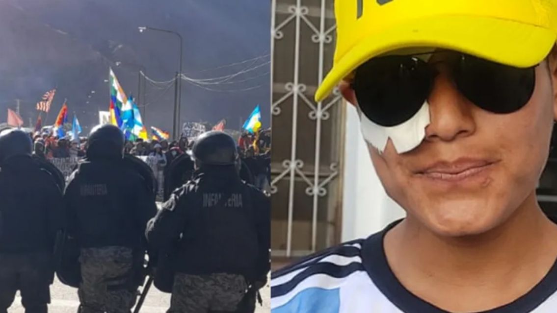 "Todos por Misael": el joven que perdió el ojo viajará a Buenos Aires para recibir el tratamiento