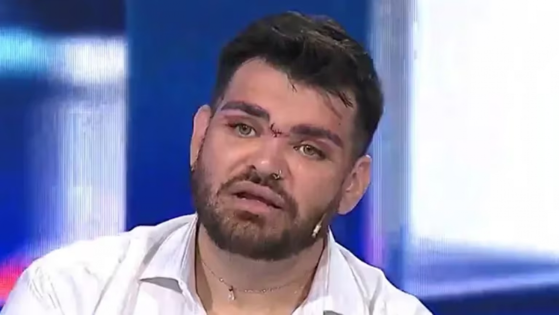 Internaron de urgencia a Fran Mariano. Es otra v�ctima de Lotocki. �Hasta cu�ndo?