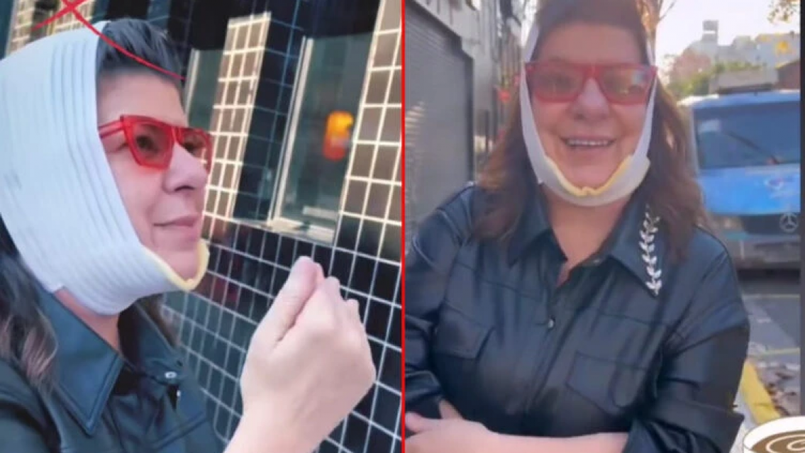 En medio de la delicada situación de Silvina Luna, Andrea Taboada se operó y quedó así