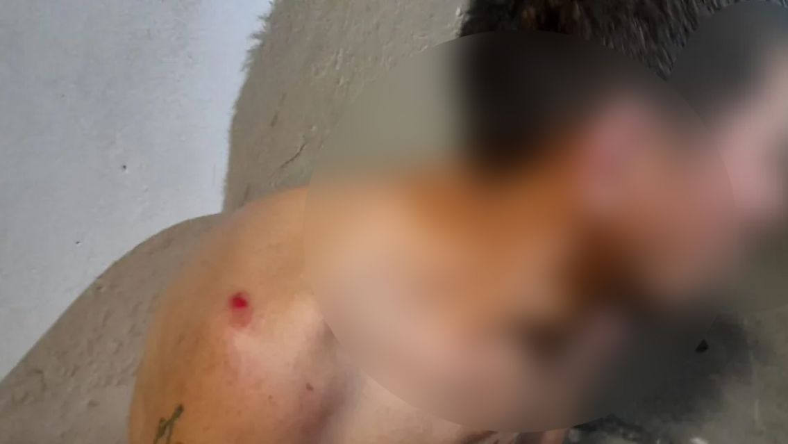 Quiso robarle a una mujer, los vecinos lo atraparon y le dieron para que tenga: as� lo dejaron